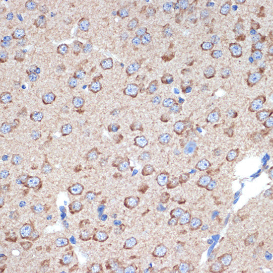 ERp29 Rabbit mAb