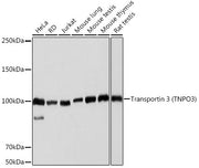 Transportin 3 (TNPO3) Rabbit mAb