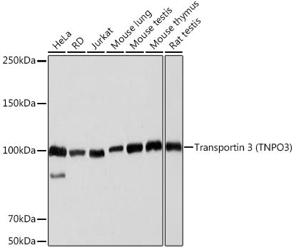 Transportin 3 (TNPO3) Rabbit mAb