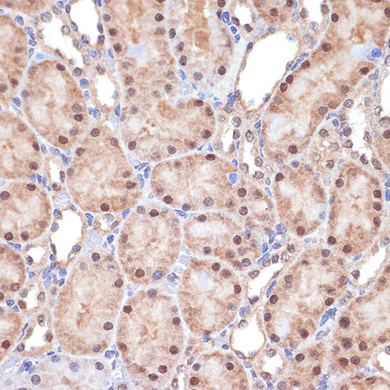 Transportin 3 (TNPO3) Rabbit mAb