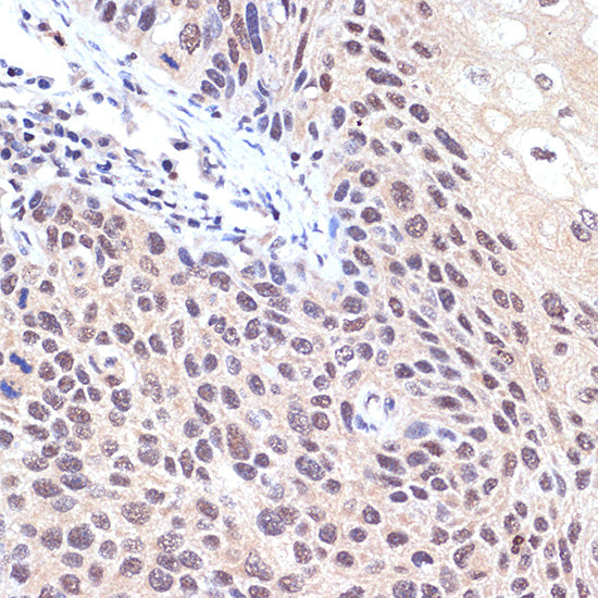 Transportin 3 (TNPO3) Rabbit mAb