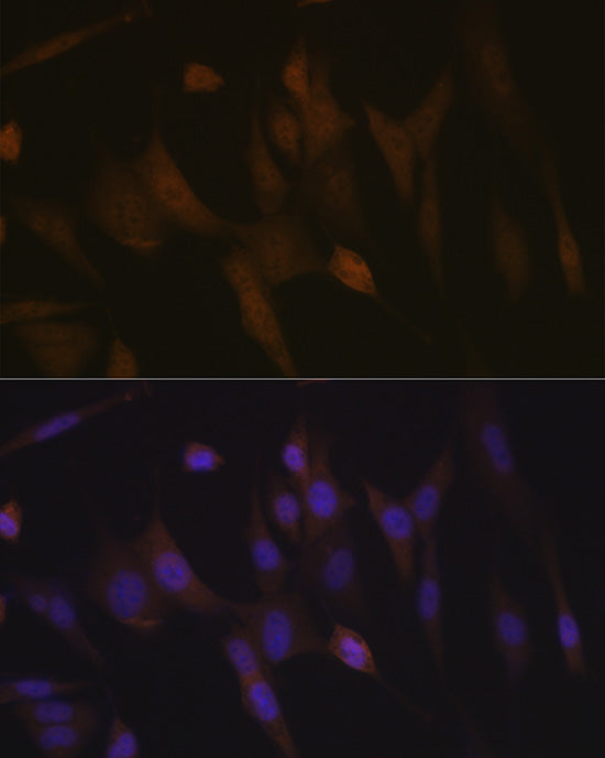 Transportin 3 (TNPO3) Rabbit mAb