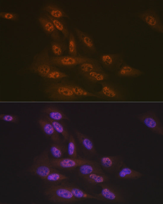 Transportin 3 (TNPO3) Rabbit mAb