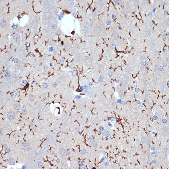 AIF1/IBA1 Rabbit mAb