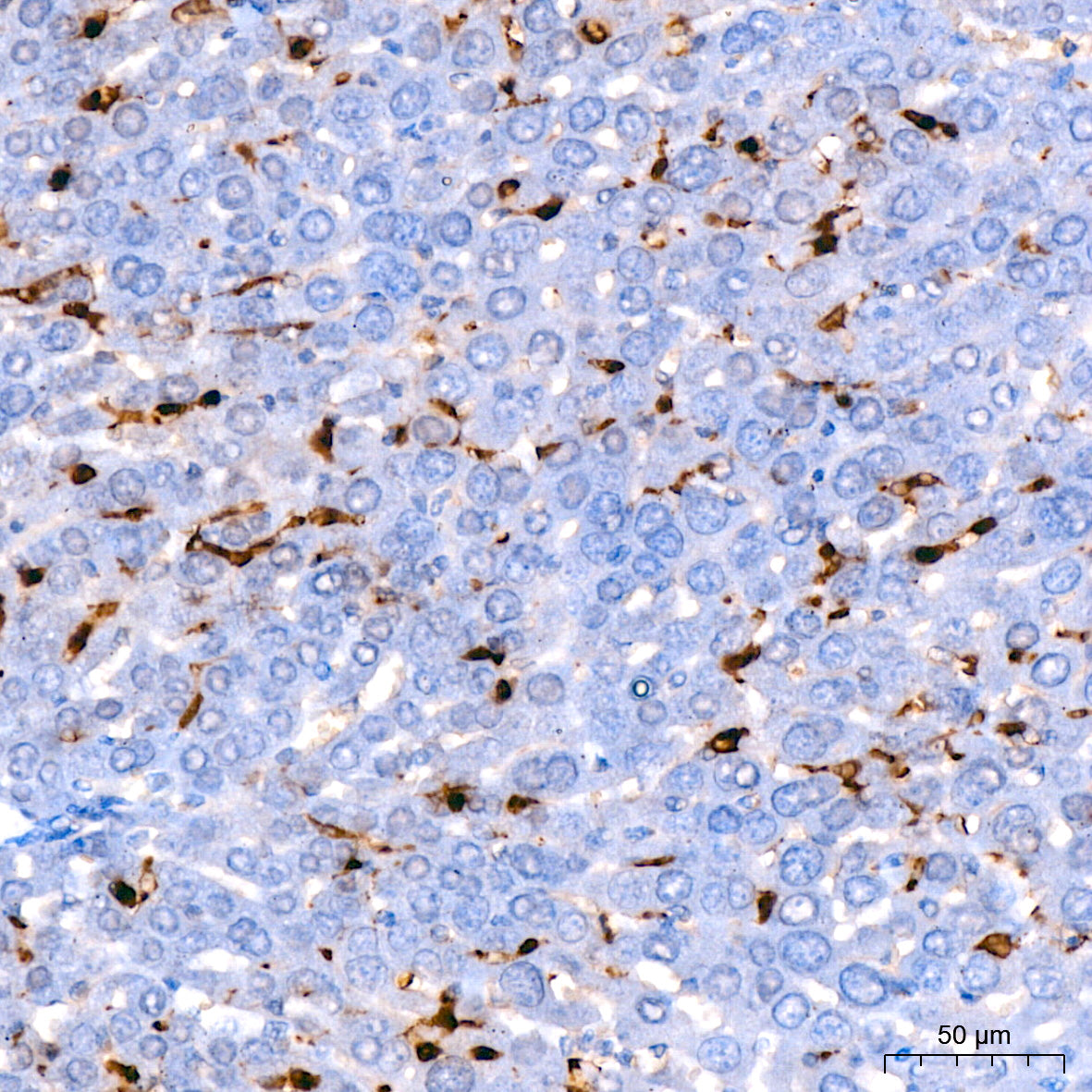 AIF1/IBA1 Rabbit mAb