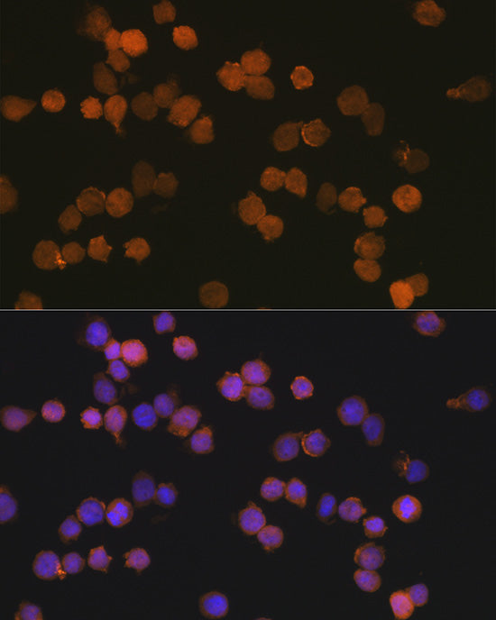 AIF1/IBA1 Rabbit mAb