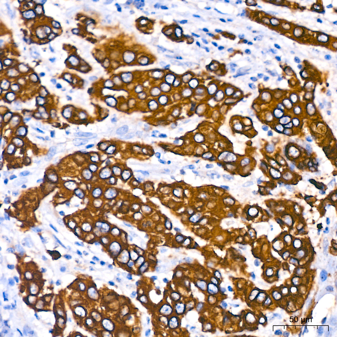 Cytokeratin 18 (KRT18) Rabbit mAb