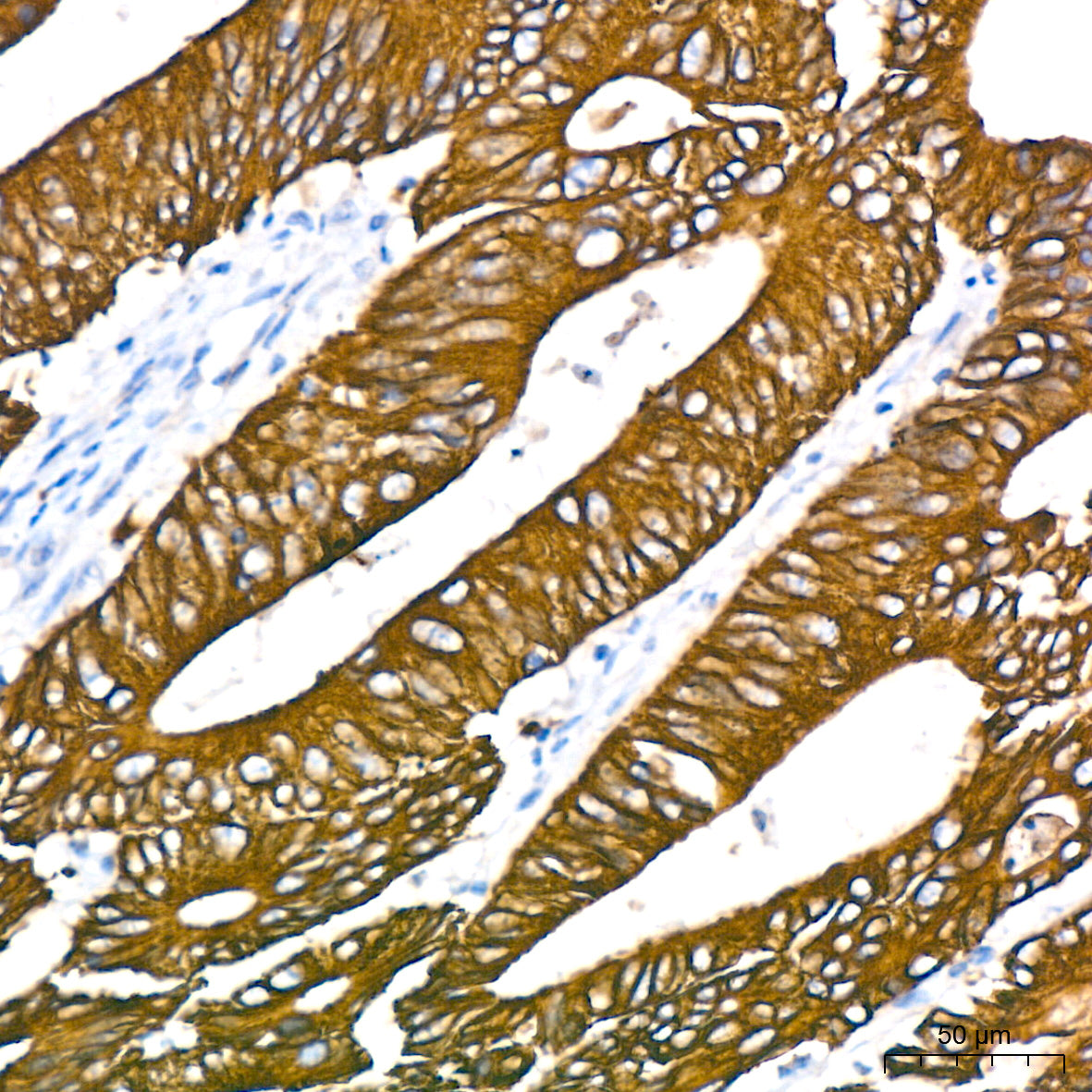 Cytokeratin 18 (KRT18) Rabbit mAb