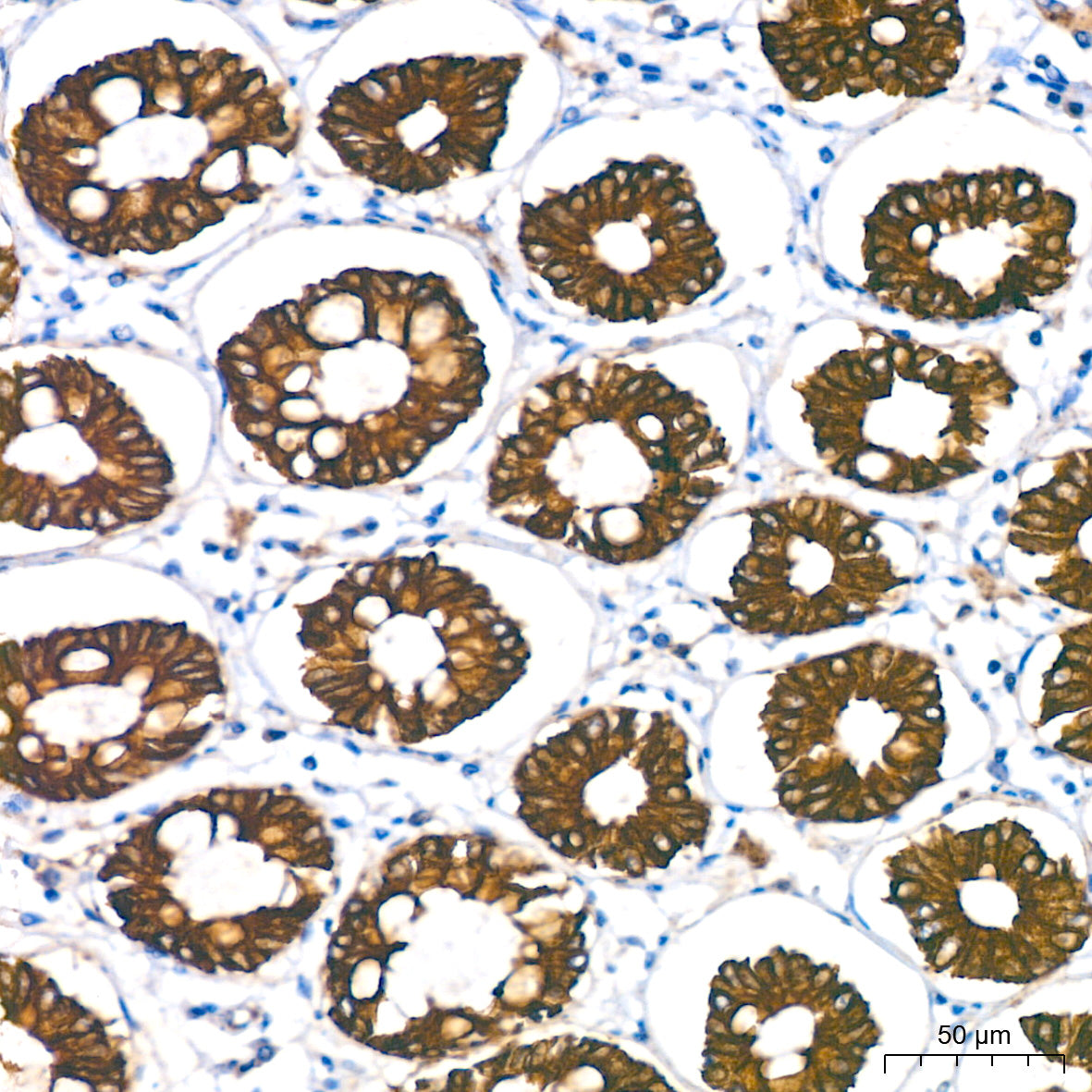 Cytokeratin 18 (KRT18) Rabbit mAb