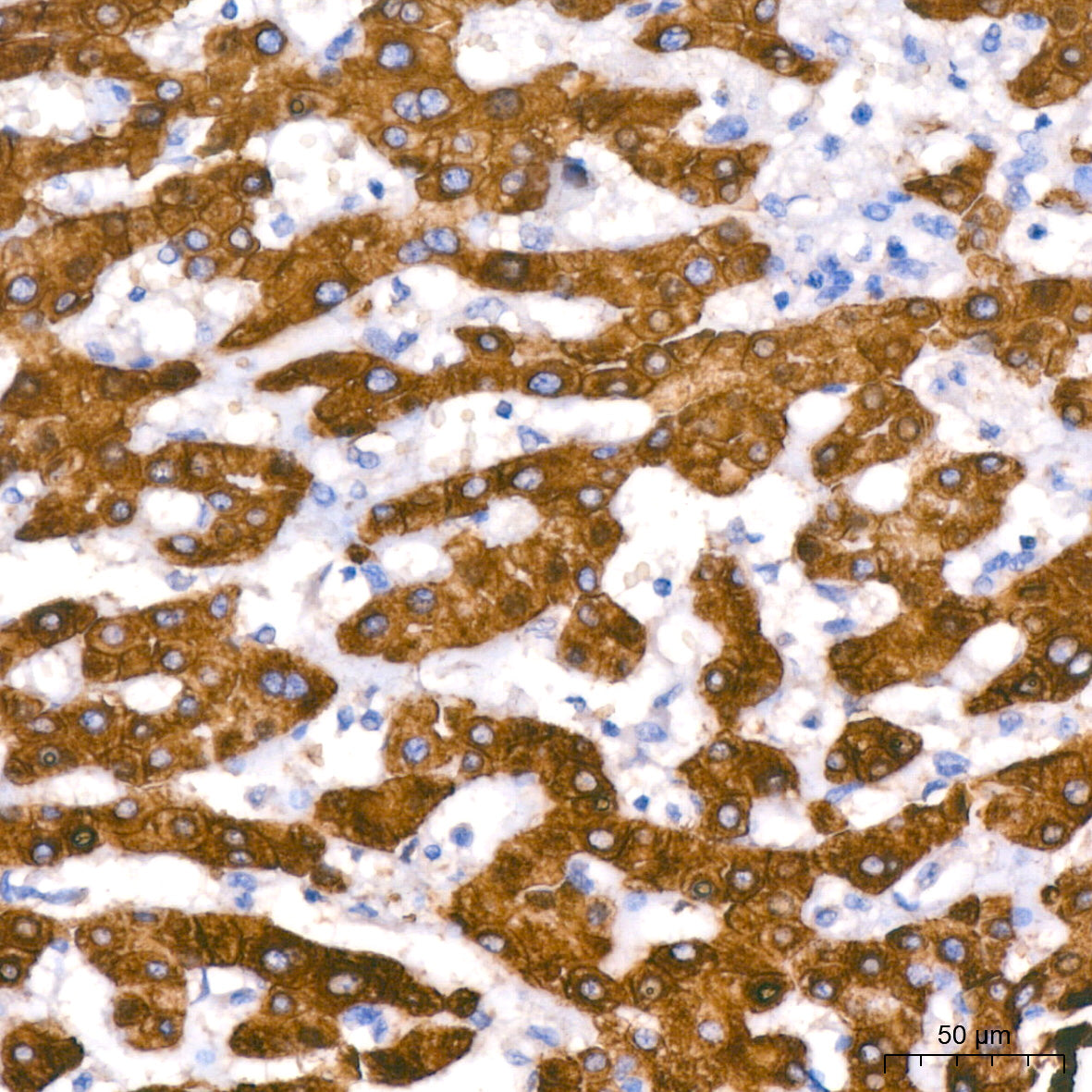 Cytokeratin 18 (KRT18) Rabbit mAb