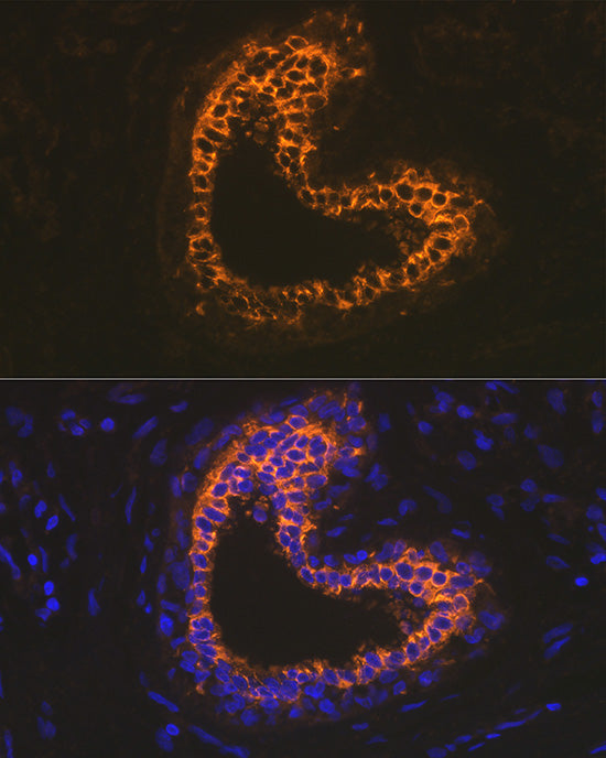 Cytokeratin 18 (KRT18) Rabbit mAb