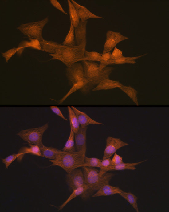 Nesprin 1 Rabbit mAb