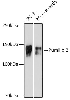 Pumilio 2 Rabbit mAb