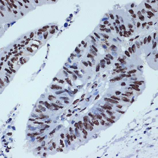 ZBTB7A/FBI-1/LRF Rabbit mAb
