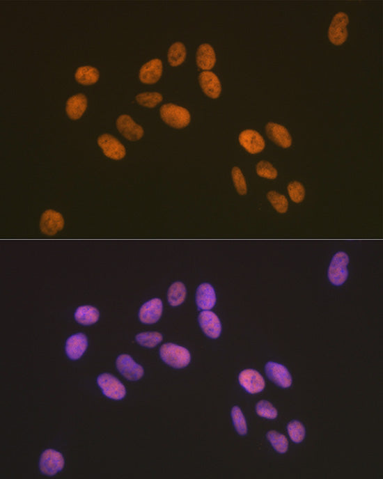ZBTB7A/FBI-1/LRF Rabbit mAb