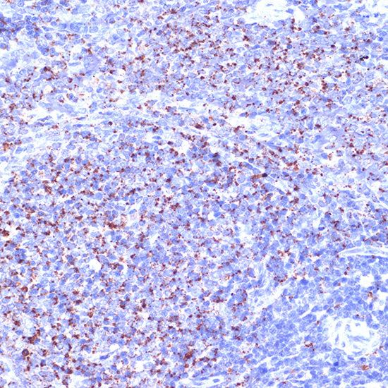 TC10/RHOQ Rabbit mAb