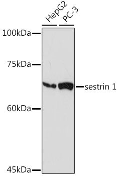 sestrin 1 Rabbit mAb