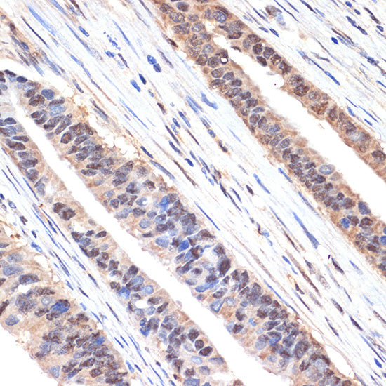 sestrin 1 Rabbit mAb