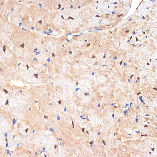 sestrin 1 Rabbit mAb