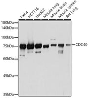 CDC40 Rabbit mAb