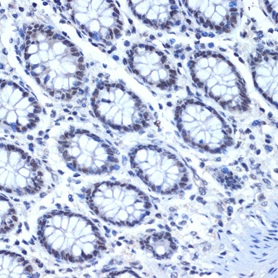 CDC40 Rabbit mAb