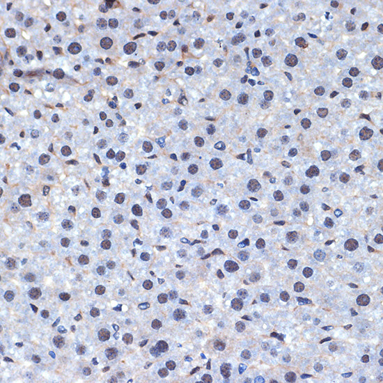 CDC40 Rabbit mAb