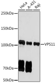 VPS11 Rabbit mAb