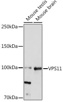 VPS11 Rabbit mAb