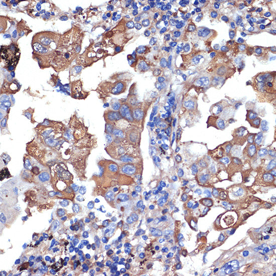 VPS11 Rabbit mAb