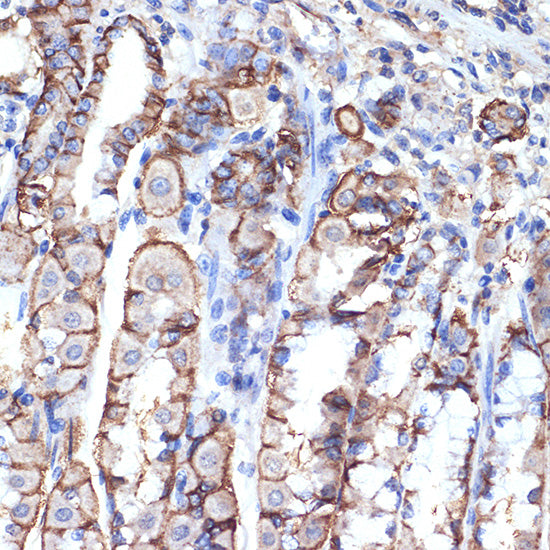 VPS11 Rabbit mAb