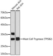 Mast Cell Tryptase (TPSB2) Rabbit mAb