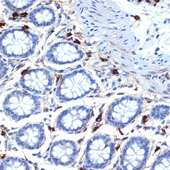 Mast Cell Tryptase (TPSB2) Rabbit mAb