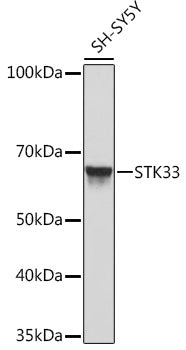 STK33 Rabbit mAb