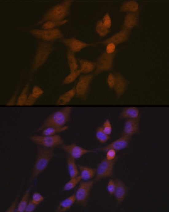 STK33 Rabbit mAb