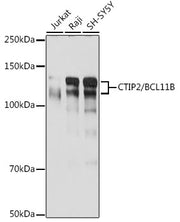 CTIP2/BCL11B Rabbit mAb