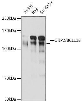 CTIP2/BCL11B Rabbit mAb