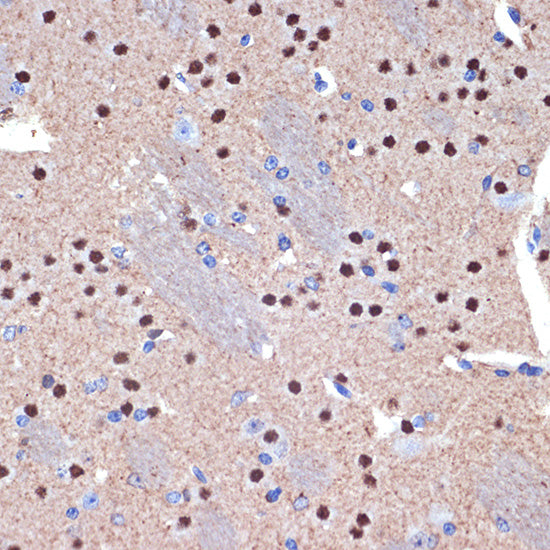 CTIP2/BCL11B Rabbit mAb