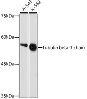 Tubulin beta-1 chain Rabbit mAb