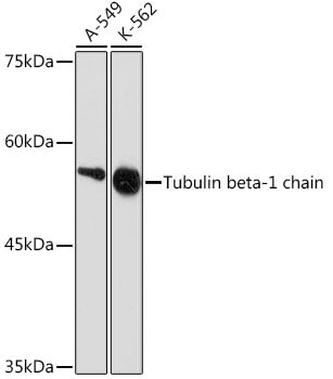 Tubulin beta-1 chain Rabbit mAb