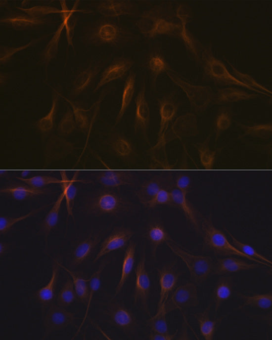 Tubulin beta-1 chain Rabbit mAb