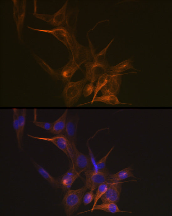 Tubulin beta-1 chain Rabbit mAb