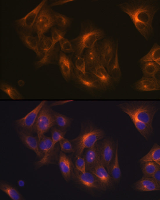 Tubulin beta-1 chain Rabbit mAb