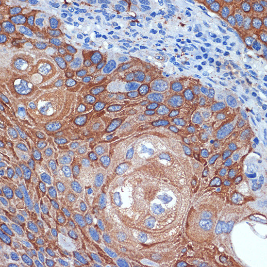 BCL2L12 Rabbit mAb