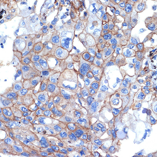 Talin 2 Rabbit mAb
