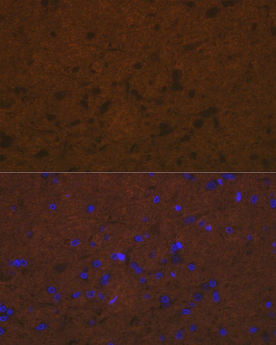 Talin 2 Rabbit mAb