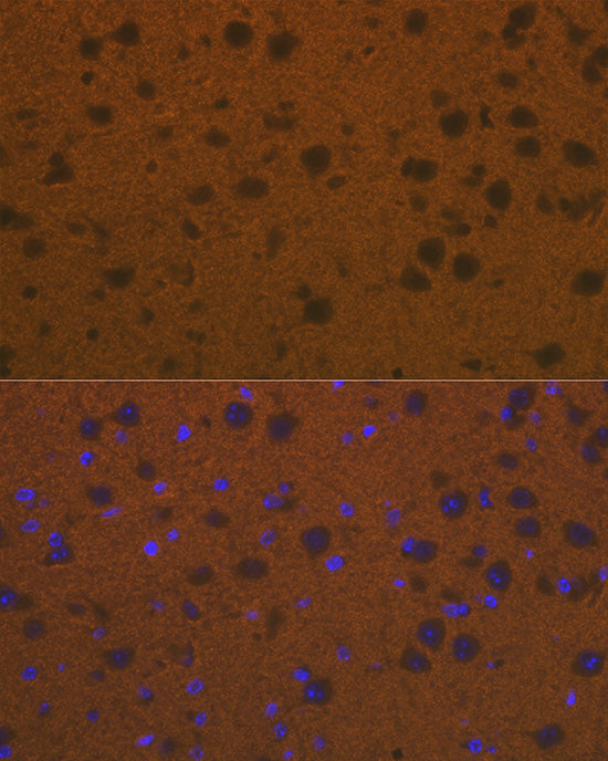 Talin 2 Rabbit mAb