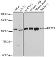 eIF2C3 Rabbit mAb
