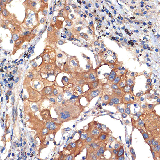 eIF2C3 Rabbit mAb
