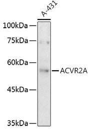 ACVR2A Rabbit pAb