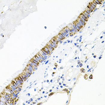 ACVR2A Rabbit pAb